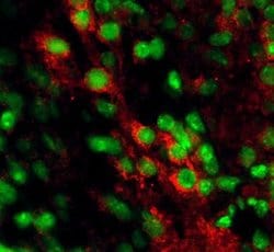 Invitrogen EphB2 Polyclonal Antibody 100 &mu;g; Unconjugated:Antibodies,