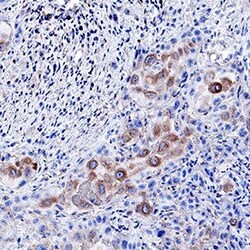Invitrogen EphB2 Polyclonal Antibody 100 &mu;g; Unconjugated:Antibodies,