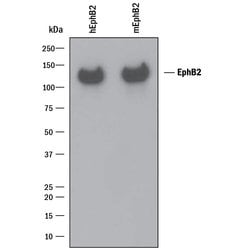 Invitrogen EphB2 Polyclonal Antibody 100 &mu;g; Unconjugated:Antibodies,