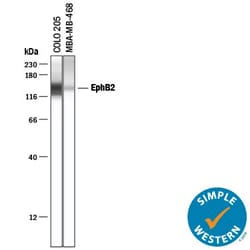 Invitrogen EphB2 Polyclonal Antibody 100 &mu;g; Unconjugated:Antibodies,