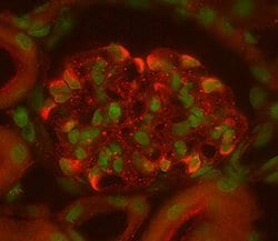 Invitrogen VEGF-164 Polyclonal Antibody 100 &mu;g; Unconjugated:Antibodies,