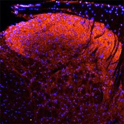 Invitrogen Neuropilin 1 Polyclonal Antibody 100 &mu;g | Buy Online | Invitrogen&trade; | Fisher Scientific