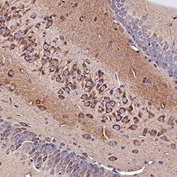 Invitrogen&trade;&nbsp;Neuropilin 1 Polyclonal Antibody