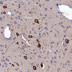 Invitrogen Neuropilin 1 Polyclonal Antibody 100 &mu;g | Buy Online | Invitrogen&trade; | Fisher Scientific