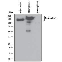 Invitrogen Neuropilin 1 Polyclonal Antibody 100 &mu;g | Buy Online | Invitrogen&trade; | Fisher Scientific