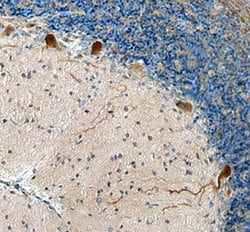 Invitrogen ADAMTS8 Polyclonal Antibody 100 &mu;g; Unconjugated:Antibodies,