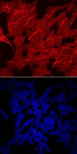 Invitrogen LPL Polyclonal Antibody 100 &mu;g; Unconjugated:Antibodies,