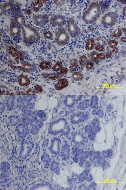 Invitrogen cIAP1 Polyclonal Antibody 100 &mu;g; Unconjugated:Antibodies,