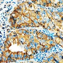 Invitrogen HAI-1 Polyclonal Antibody 100 &mu;g; Unconjugated:Antibodies,