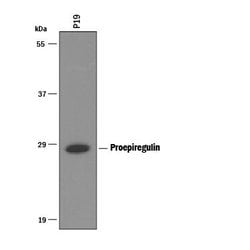 Invitrogen Epiregulin Polyclonal Antibody 100 &mu;g; Unconjugated:Antibodies,