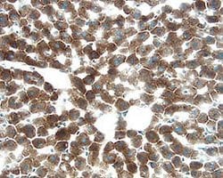 Invitrogen FGL1 Polyclonal Antibody 100 &mu;g | Buy Online | Invitrogen&trade; | Fisher Scientific