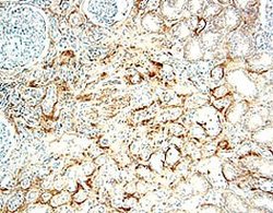Invitrogen IL17RB Polyclonal Antibody 100 &mu;g; Unconjugated:Antibodies,