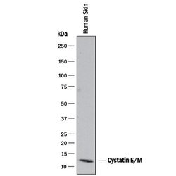 Invitrogen Cystatin M Polyclonal Antibody 100 &mu;g | Buy Online | Invitrogen&trade; | Fisher Scientific