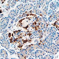 Invitrogen IGFBP7 Polyclonal Antibody 100 &mu;g; Unconjugated:Antibodies,