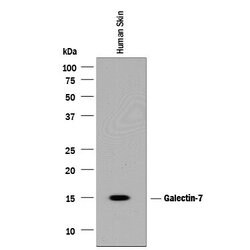 Invitrogen Galectin 7 Polyclonal Antibody 100 &mu;g; Unconjugated:Antibodies,