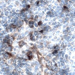 Invitrogen FGFBP1 Polyclonal Antibody 100 &mu;g; Unconjugated:Antibodies,