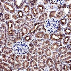 Invitrogen PDGF-C Polyclonal Antibody 100 &mu;g; Unconjugated:Antibodies,