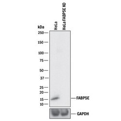 Invitrogen FABP5 Polyclonal Antibody 100 &mu;g | Buy Online | Invitrogen&trade; | Fisher Scientific
