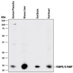 Invitrogen FABP5 Polyclonal Antibody 100 &mu;g | Buy Online | Invitrogen&trade; | Fisher Scientific