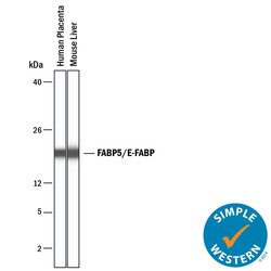 Invitrogen FABP5 Polyclonal Antibody 100 &mu;g | Buy Online | Invitrogen&trade; | Fisher Scientific