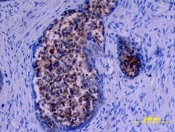 Invitrogen Kallikrein 11 Polyclonal Antibody 100 &mu;g; Unconjugated:Antibodies,