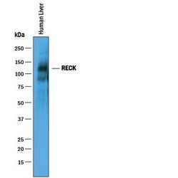 Invitrogen RECK Polyclonal Antibody 100 &mu;g; Unconjugated:Antibodies,