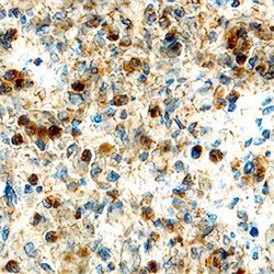 Invitrogen CD267 (TACI) Polyclonal Antibody 100 &mu;g; Unconjugated:Antibodies,