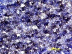 Invitrogen IL-6 Receptor Polyclonal Antibody 100 &mu;g; Unconjugated:Antibodies,