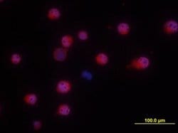 Invitrogen NKp46 Polyclonal Antibody 100 &mu;g; Unconjugated:Antibodies,