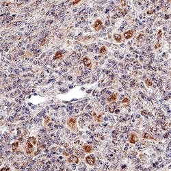 Invitrogen NKp46 Polyclonal Antibody 100 &mu;g; Unconjugated:Antibodies,