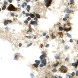 FGFR5 Polyclonal Antibody, Invitrogen 100 &mu;g; Unconjugated:Antibodies,