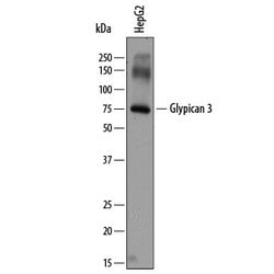 Invitrogen Glypican 3 Polyclonal Antibody 100 &mu;g | Buy Online | Invitrogen&trade; | Fisher Scientific