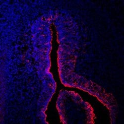 Invitrogen hCV-2 Polyclonal Antibody 100 &mu;g; Unconjugated:Antibodies,