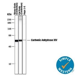 Invitrogen Carbonic Anhydrase XIV Polyclonal Antibody 100 &mu;g; Unconjugated:Antibodies,