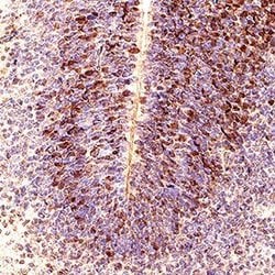 Invitrogen ASCL1 Polyclonal Antibody 100 &mu;g | Buy Online | Invitrogen&trade; | Fisher Scientific