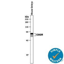 Invitrogen CAR Polyclonal Antibody 100 &mu;g; Unconjugated:Antibodies,