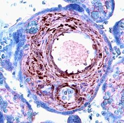 Invitrogen FGF9 Polyclonal Antibody 100 &mu;g; Unconjugated:Antibodies,