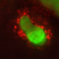 Invitrogen IL10RA Polyclonal Antibody 100 &mu;g; Unconjugated:Antibodies,