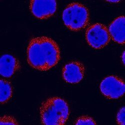 Invitrogen IL31RA Polyclonal Antibody 100 &mu;g; Unconjugated:Antibodies,