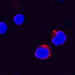 Invitrogen IL-31 Polyclonal Antibody 100 &mu;g; Unconjugated:Antibodies,