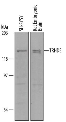 Invitrogen TRHDE Polyclonal Antibody 100 &mu;g; Unconjugated:Antibodies,
