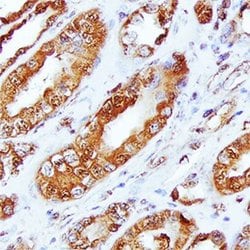 Invitrogen Nectin 3 Polyclonal Antibody 100 &mu;g; Unconjugated:Antibodies,