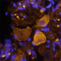 Invitrogen Neurofascin Polyclonal Antibody 100 &mu;g; Unconjugated:Antibodies,