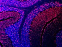Invitrogen SEMA3E Polyclonal Antibody 100 &mu;g; Unconjugated:Antibodies,