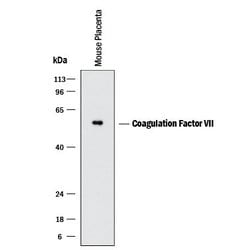 Invitrogen Factor VII Polyclonal Antibody 100 &mu;g; Unconjugated:Antibodies,