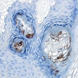 Invitrogen GLI1 Polyclonal Antibody 100 &mu;g; Unconjugated:Antibodies,