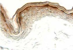Invitrogen Eotaxin 2 Polyclonal Antibody 100 &mu;g; Unconjugated:Antibodies,