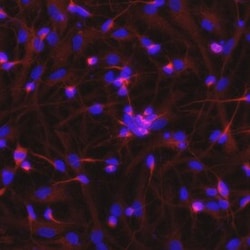 Invitrogen Nogo-A Polyclonal Antibody 100 &mu;g; Unconjugated:Antibodies,