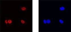 Invitrogen ZNF24 Polyclonal Antibody 100 &mu;g; Unconjugated:Antibodies,