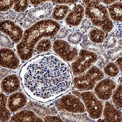Invitrogen CUBN Polyclonal Antibody 100 &mu;g; Unconjugated:Antibodies,